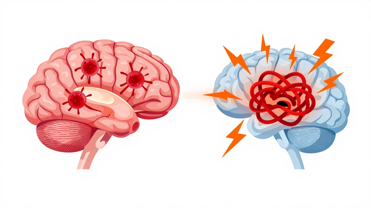 Medical illustration showing antibodies attacking brain basal ganglia causing symptoms